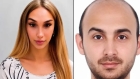 تركيا.. هارب من السجن يتنكر كامرأة 8 سنوات والبصمات تفضحه